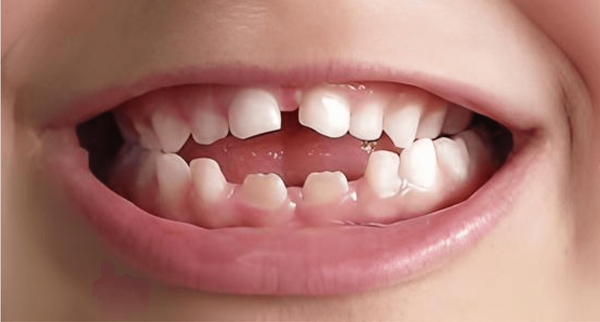 Criança no dentista