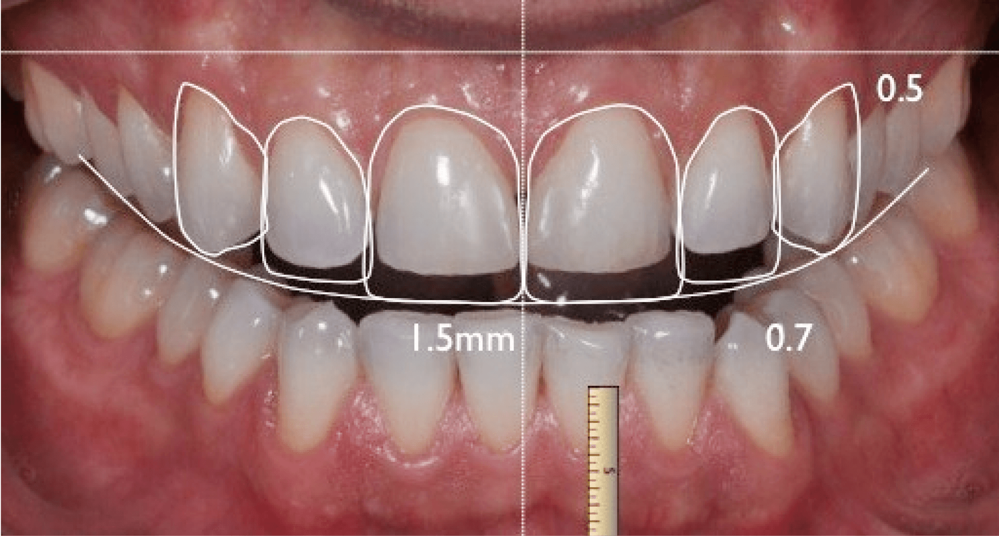 Criança no dentista